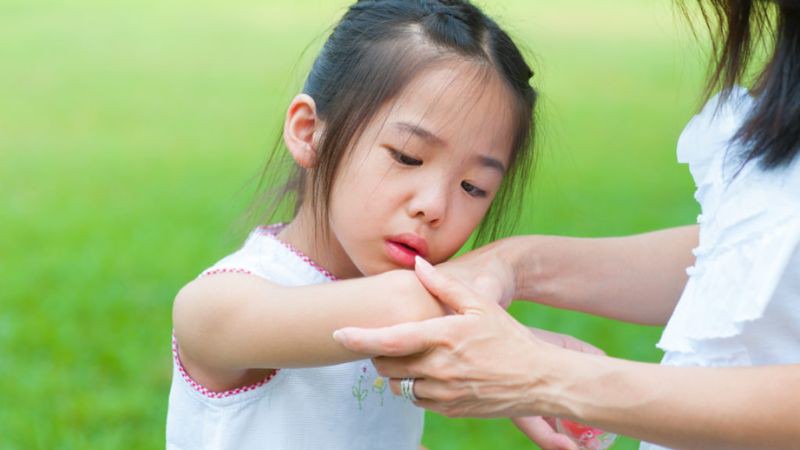 Tình trạng khuỷu tay cô giữ trẻ