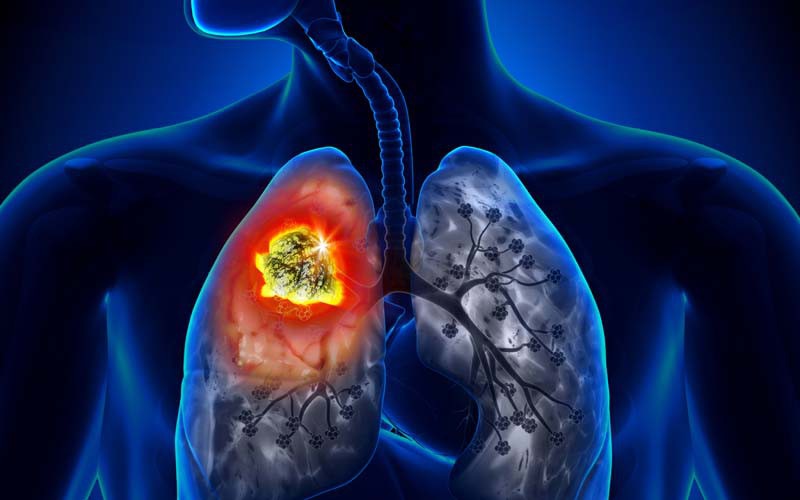 Các loại nấm ăn được và những tác dụng thần kỳ của nấm