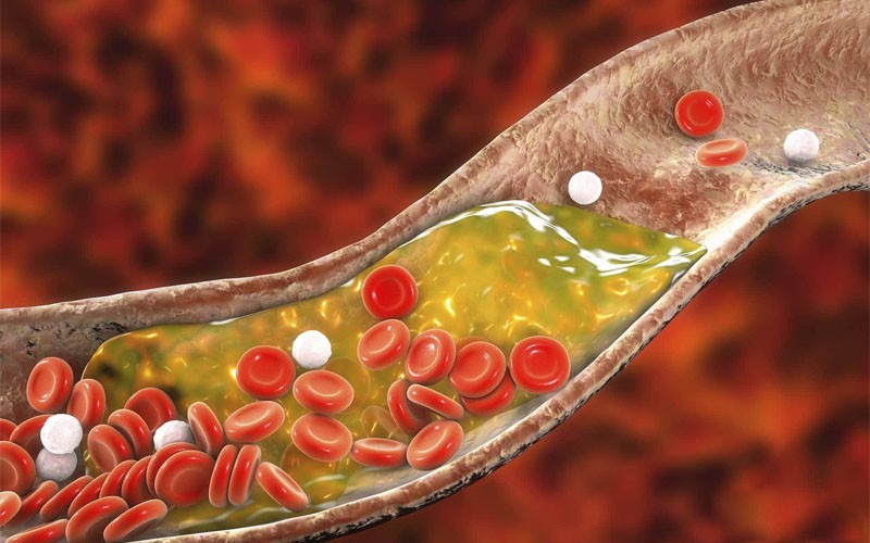 Nấm mỡ giúp làm giảm lượng cholesterol