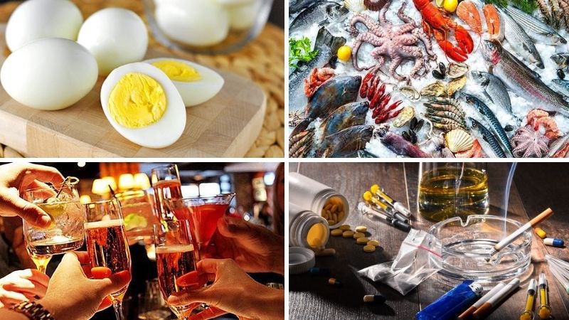 Cầm kiêng gì sau khi cắt mí?