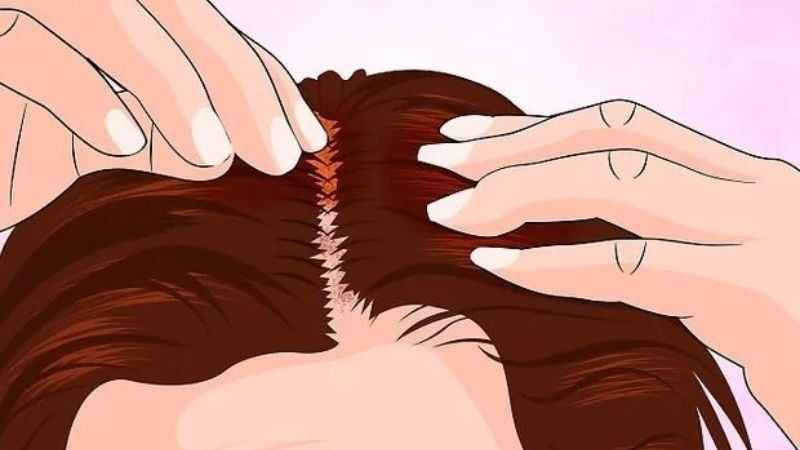 Thoa dầu lên da đầu và tóc